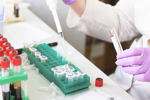 lab urine test