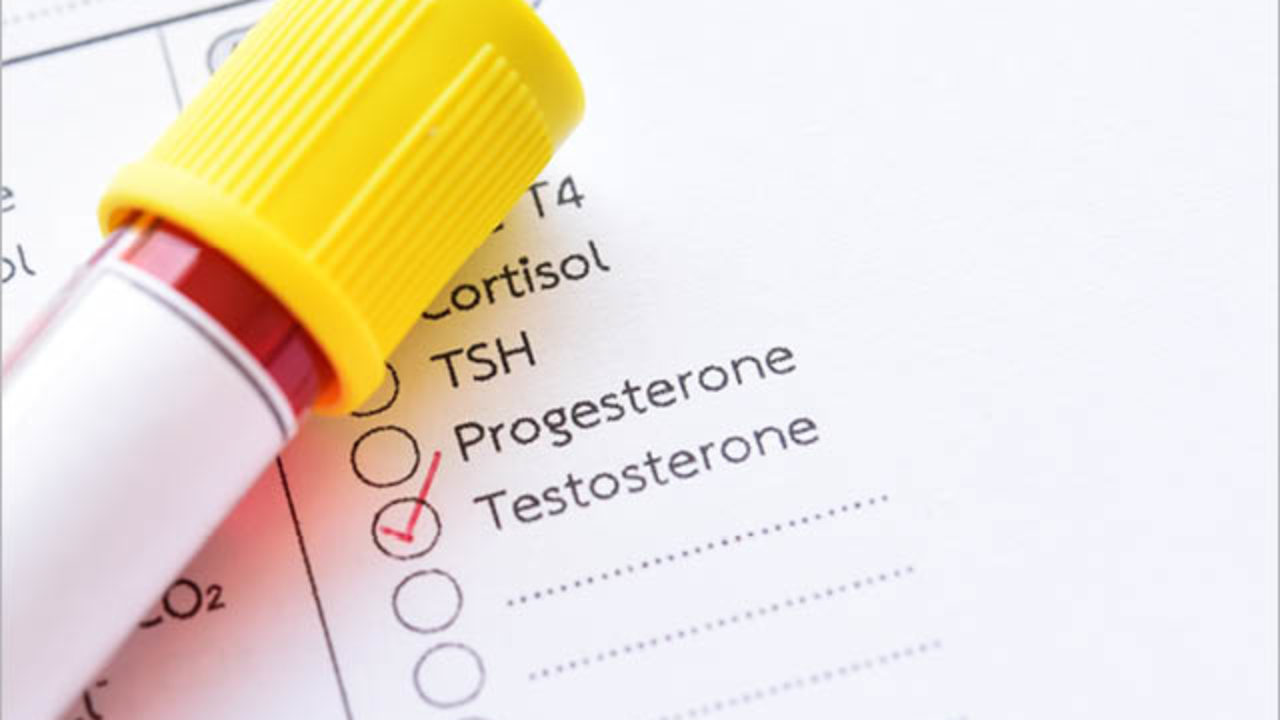 testosterone results